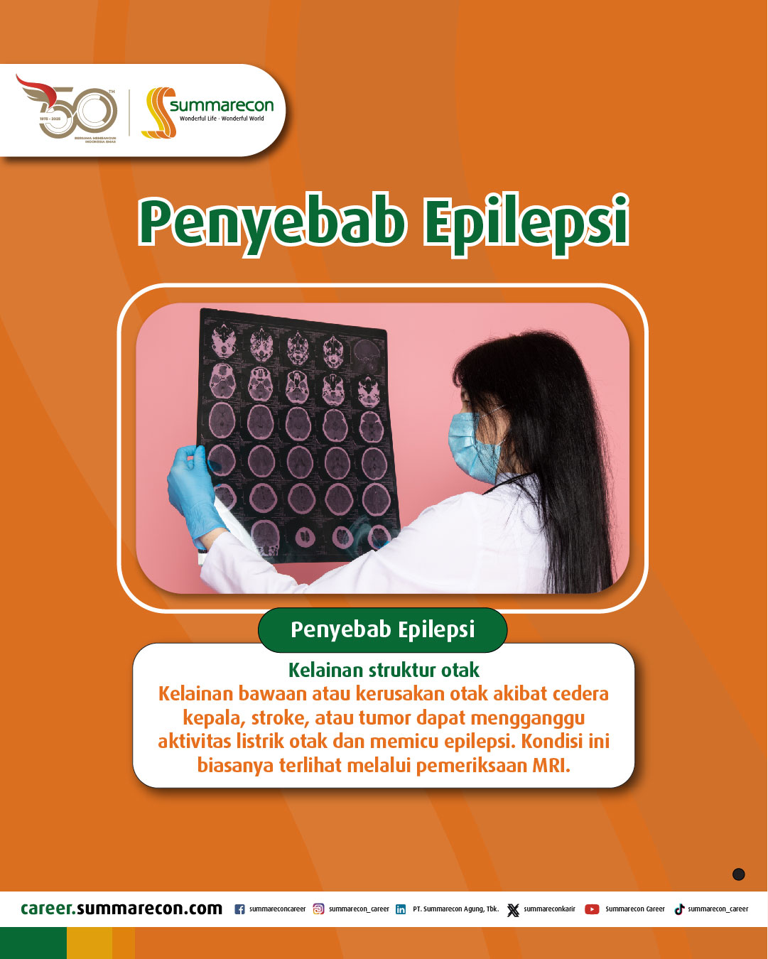 Penyebab Epilepsi (4/4)