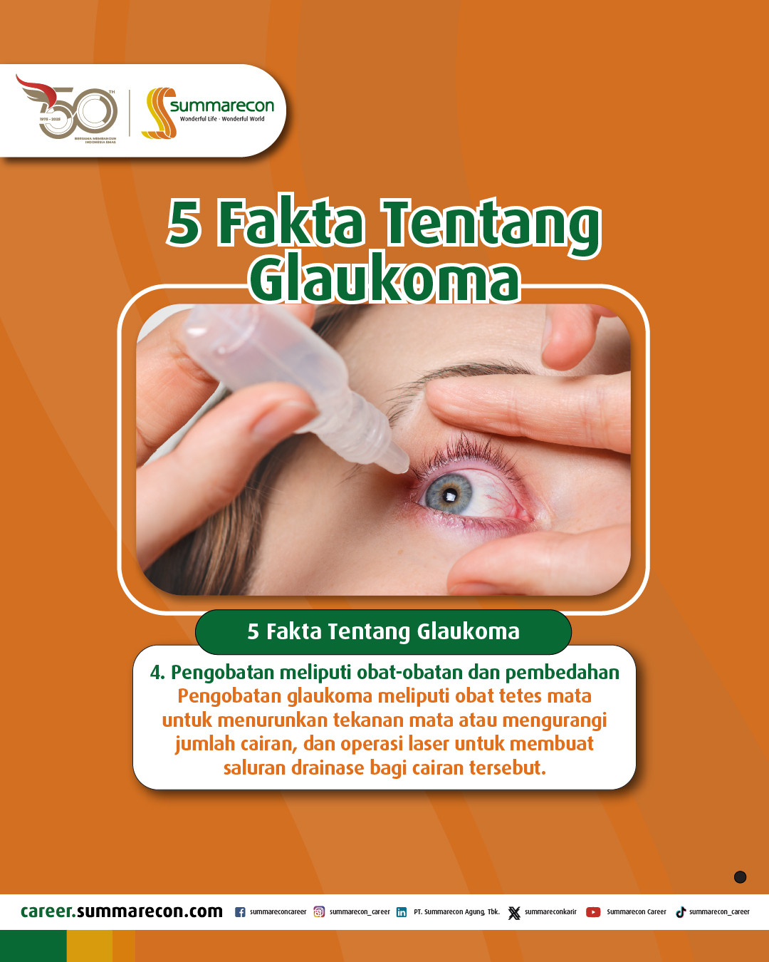 5 Fakta Tentang Glaukoma (4/5)
