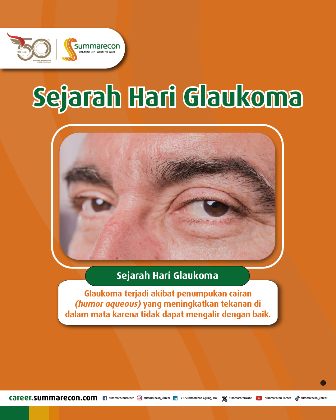 Sejarah Hari Glaukoma (4/4)