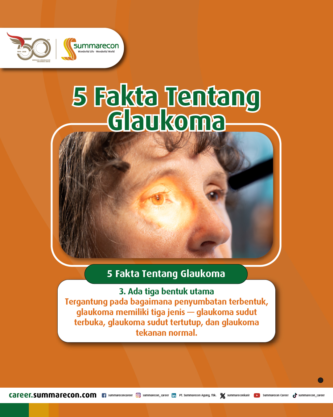 5 Fakta Tentang Glaukoma (3/5)